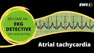 Atrial tachycardia  EKG Detective [upl. by Stephine]