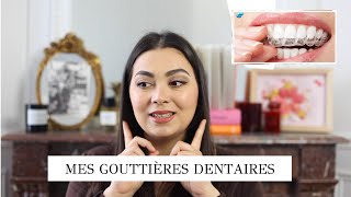 TOUT SAVOIR SUR MON TRAITEMENT DE GOUTTIÈRES DENTAIRES PRIX  ÇA MARCHE  DOULEUR [upl. by Dart]