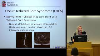 quotImaging of Patient with Occult Tethered Cord Syndromequot  Amanda Baker MD [upl. by Nylloh]