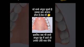 Angutha chusne ke nuksan Puri video me dek sakte h अंगूठा चूसने kesa h 😇 [upl. by Nyledam246]