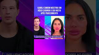 kamila simione mostrou um vídeo exibindo o seu rosto após procedimento [upl. by Martha]