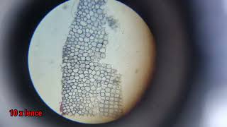 To identify parenchyma and sclerenchyma tissues in plants from prepared slides and draw diagram [upl. by Eenyaj]