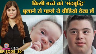 क्यों होता है Down Syndrome जिसमें बच्चों का मानसिक विकास देरी से होता है Sehat Ep 80 [upl. by Ricketts]