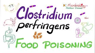 Clostridium perfringens Food 🥘 Poisoning 🤮  Microbiology 🧫 amp Infectious Diseases [upl. by Maryjo]