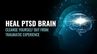 Heal PTSD Brain  Cleanse Yourself Out From Traumatic Experience  Powerful PTSD Cure  417 hz Music [upl. by Blaseio709]