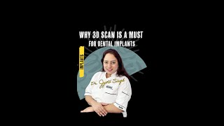 Why 3D Scan is a Must for Dental Implants [upl. by Iruam]