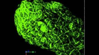 Microtubule dynamics in an Arabidopsis leaf [upl. by Nathanael]