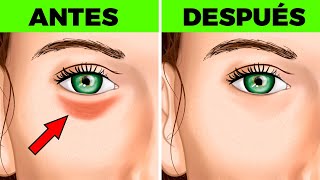 👓18 REMEDIOS FÁCILES PARA ELIMINAR LAS BOLSAS EN LOS OJOS [upl. by Inanuah618]