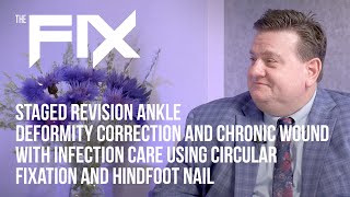 The FIX with Dr M Subik  Revision Ankle Deformity Correction w Circular Fixation amp Hindfoot Nail [upl. by Hniv]