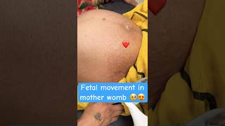 fetal movement in mother wombpregnancy periodviral [upl. by Lorrimer]