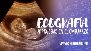 Ecografía semana 12 y pruebas para detectar anomalías cromosómicas [upl. by Eberle733]