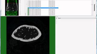 Setting the trabecular VOI for mouse femur [upl. by Alliuqet]