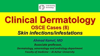 Clinical Dermatology OSCE Cases 8 Skin Infections and Infestations [upl. by Lebazej]