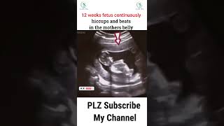 12 weeks fetus continuously hiccups and beats in the mothers belly ultrasound pregnant hiccup [upl. by Etteraj124]