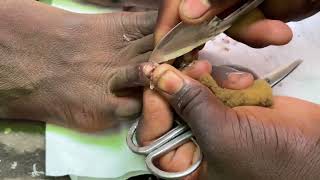 ASMR GENTLE CLEAN NAILS PERFECTLY CLEANED BY AN EXPERIENCED NAIL CUTTER STREET PEDICURE [upl. by Eninahpets]