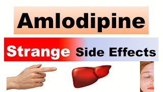 Amlodipine Side effects [upl. by Davena315]