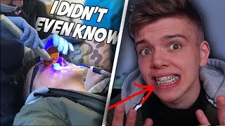 I GOT BRACES WITHOUT KNOWING  NOT CLICKBAIT Story Time My Experience getting braces [upl. by Nessej]