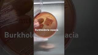 Burkholderia cepacia trên thạch MC BurkholderiaCepacia ViKhuanNguyHiem MacConkey YHoc SucKhoe [upl. by Ynohtnaluap721]