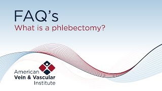 What is a phlebectomy  American Vein amp Vascular Institute [upl. by Hooker117]