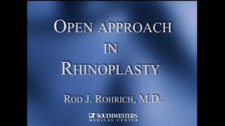 2 Open Approach Rhinoplasty [upl. by Boffa795]