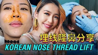 埋线隆鼻分享 Korean Nose Thread Lift Experience ft QampA  beautywithaerisk [upl. by Hemphill223]