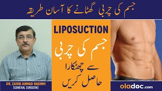 What You Need To Know About Liposuction  Best Way To Lose Fat  Liposuction Procedure And Benefits [upl. by Notlek]