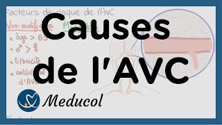 AVC causes  AVC facteurs de risque [upl. by Ruvolo]