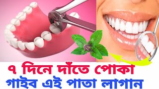 date poka lagle ki korbo  date poka valo korar upay  teeth poka [upl. by Serdna]