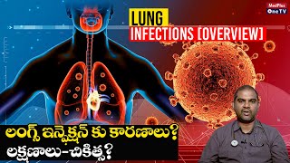 Lung Infections 4 Types of Lung Infections You Must Know l Dr V Laxman Babu MedPlusONETV [upl. by Eivets775]