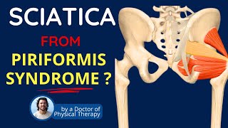 Piriformis Syndrome Sciatica Symptoms amp Back Pain [upl. by Nylsirk459]