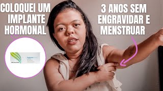 COLOQUEI UM IMPLANTE HORMONAL E QUASE DEU ERRADOMÃE COM NANISMO [upl. by Rego445]