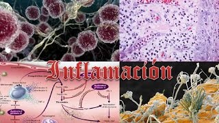 Inflamación aguda y crónica [upl. by Arianne20]