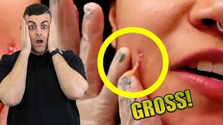 Reacting to INFECTED CHEEK Piercing 🚨Warning Pus🚨 [upl. by Anaert757]