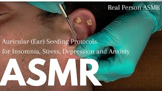 Auricular Ear Seeding for Insomnia Stress Depression and Anxiety ft Tom 👂🏼 Real Person ASMR 🧡 [upl. by Dennison]