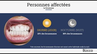 Le bruxisme grincement et serrement des dents  TV de Salle dattente Dentiste [upl. by Yarised966]