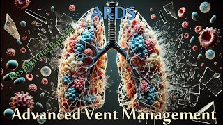 ARDS amp Advanced Interventions Critical Care  Pulmonary Series  Recorded Live [upl. by Wade]