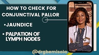 How to check for Conjunctival pallor Jaundice and Palpation of Lymph nodes [upl. by Claudina]