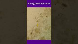 Strongyloides stercoralis [upl. by Aztilem412]