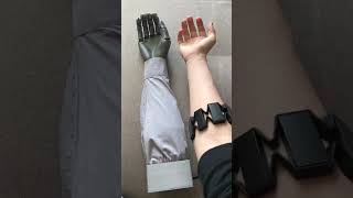 Electric prosthetic hand project [upl. by Marybelle]