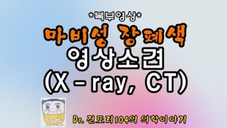 마비성 장폐색증paralyticadynamic ileus 영상소견abdominal Xray CT [upl. by Gnex]