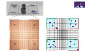 Counting cells on a hemocytometer [upl. by Surovy]