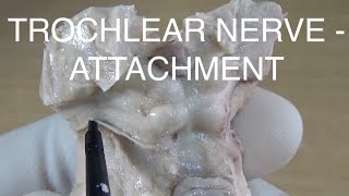 Trochlear nerve  Attachment at brainstem [upl. by Euf531]