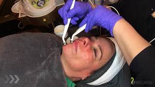 Facial Protocol with Microcurrent and Nano Infusion [upl. by Huntlee675]