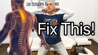 INTENSE Chiropractic Cracking Therapy for Spinal Degeneration [upl. by Alset]