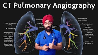 What is CT pulmonary angiography  DrEducation [upl. by Adlez]