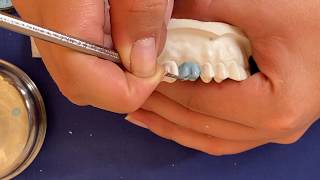 Encerado de un primer molar superior FACIL Paso a paso  upper first molar wax up [upl. by Emolas]