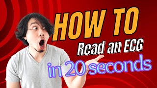 How to read an ECG in 20 seconds  ECG made supereasy  2024 [upl. by Roda124]