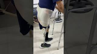 amputee rehab gait prosthetics artificiallimb artificiallimbcenter shorts [upl. by Hedges]