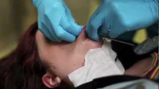 6g labret piercing procedure [upl. by Delwin]