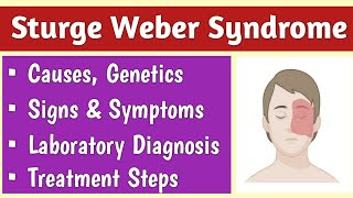 Sturge Weber Syndrome SWS Causes Signs amp Symptoms Diagnosis and Treatment [upl. by Namyw994]